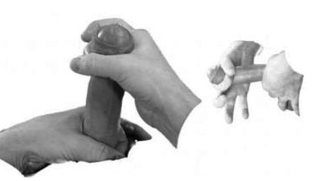 Penis sprain to increase